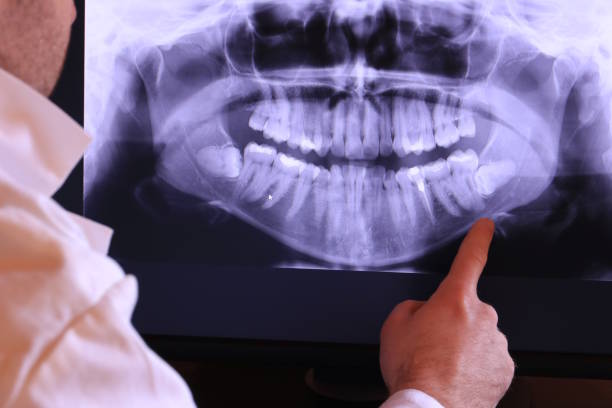 Best Urgent Care for Lost Fillings or Crowns in Lees Summit, MO
